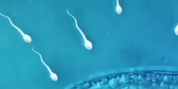 La Primera Carrera De Espermatozoides De La Historia Se Celebrara En Los Angeles