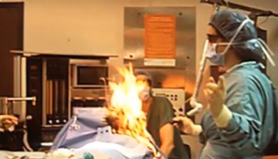 Una Mujer Provoco Un Incendio En El Quirofano Porque Se Le Escapo Un Pedo Mientras La Operaban Con Lazer