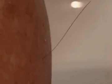 Cuidando Mi Ultimo Pelo Como Si Fuera De Oro