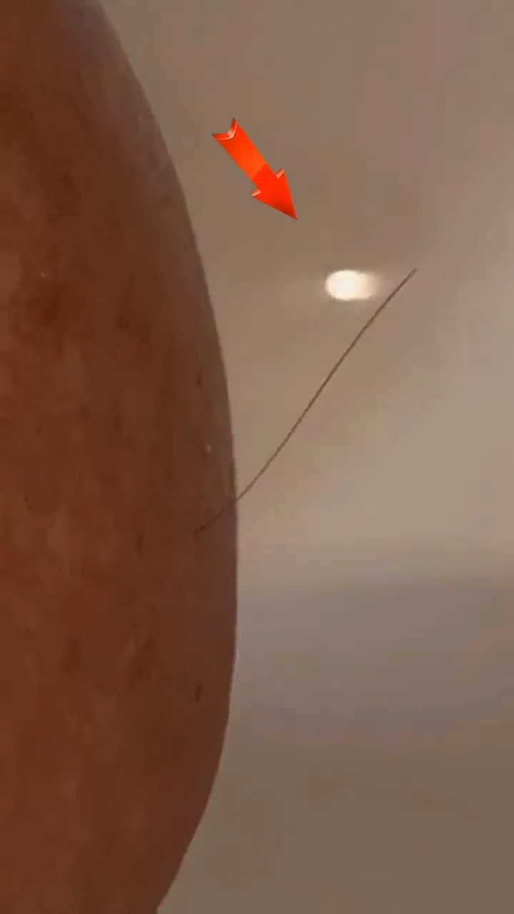 Cuidando Mi Ultimo Pelo Como Si Fuera De Oro