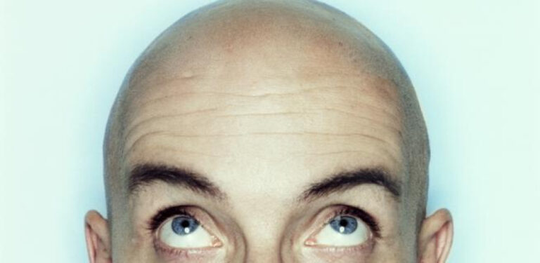 Llamar Calvo A Un Hombre Es Acoso Sexual Segun Un Tribunal De Reino Unido