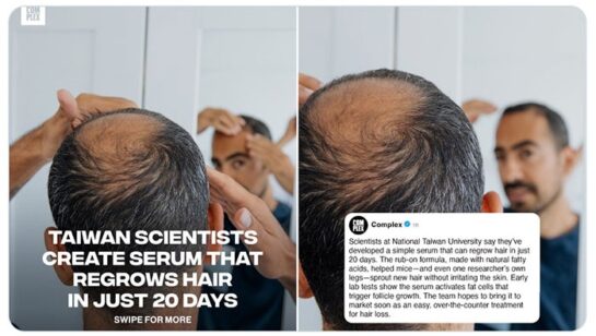 Descubren una posible 'cura' para la calvicie que podría lograr el crecimiento del pelo en 20 días. 14 Captura de Pantalla 2025 10 28 a las 21.34.54