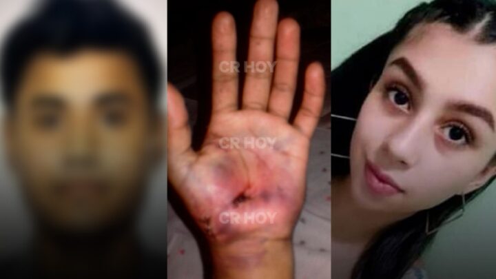 Caso Nadia mano Buzano Paisano2 720x4051 1