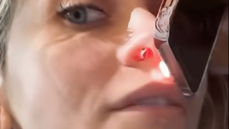 Paris jackson sorprende al mostrar su tabique nasal, perforado por las drogas!!! 1 sdfsdfsdfsdf 1