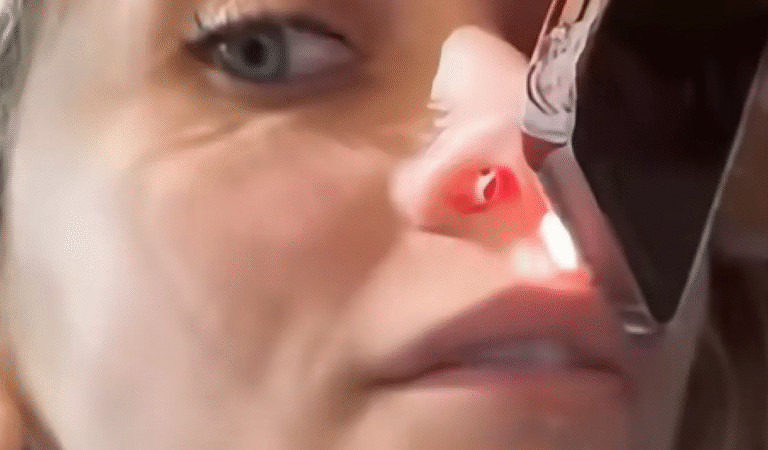 Paris jackson sorprende al mostrar su tabique nasal, perforado por las drogas!!!