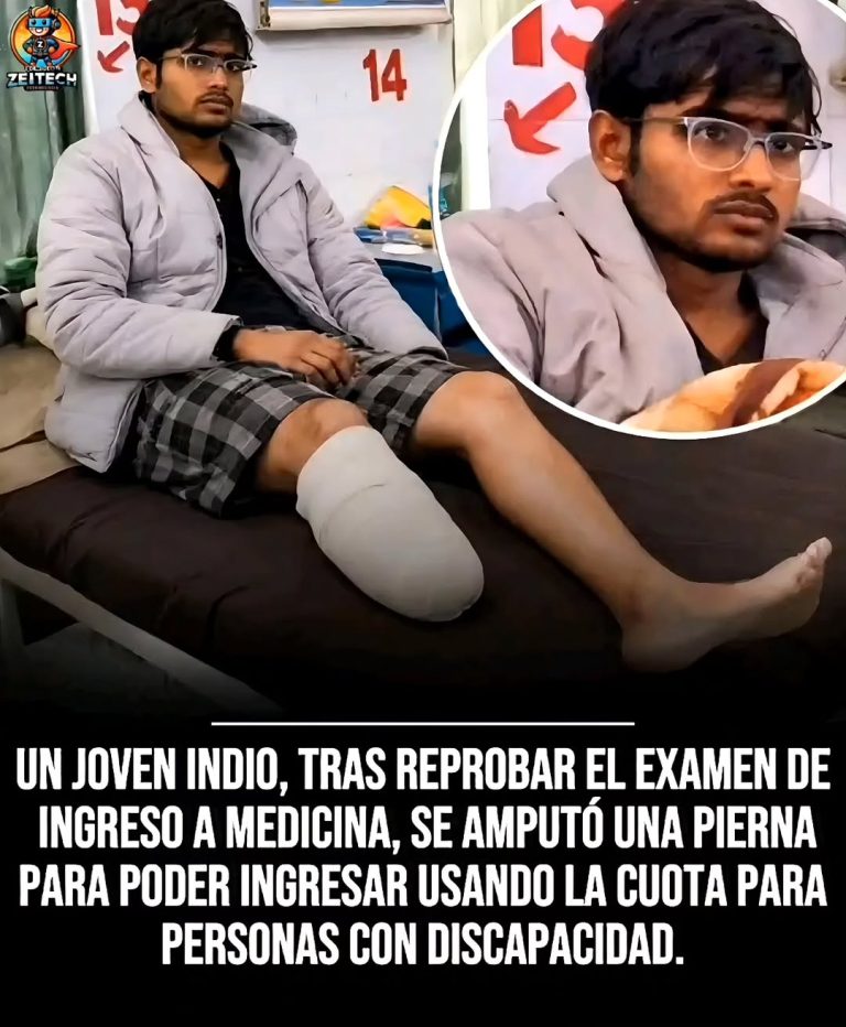 Se аmputа una pierna para poder entrar en la facultad de medicina como discapacitado. 1 wergfqweaf 768x9321 1