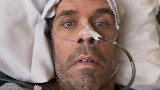 perez hilton health scare explained1
