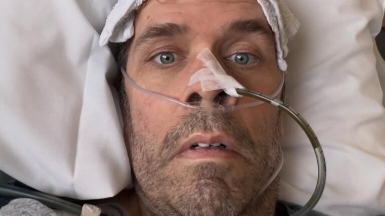 El bloguero Perez Hilton es hospitalizado tras autolesionarse con un cuchillo. (Video) 1 perez hilton health scare explained1